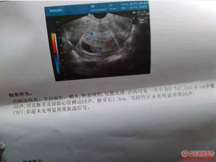 宁德妇科：早孕试纸一深一浅是怀孕吗？