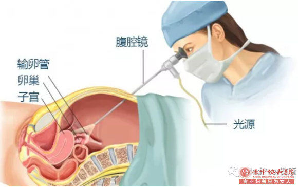 宁德安定医院宫外孕手术最佳时间是什么时候？